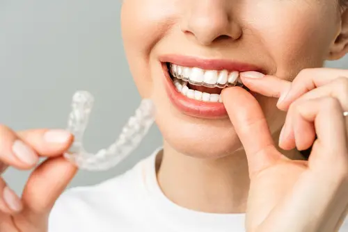 Invisalign - Mariana Orthodontics