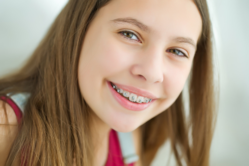 life with braces dr. mariana orthodontics monroe wa