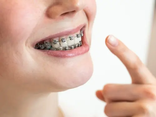 loose teeth